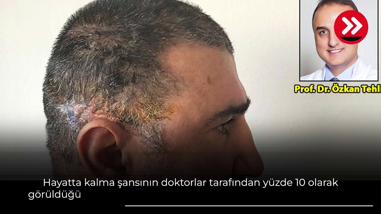 İstanbul'da, doğum gününde bu hale geldi! 'Mucize adam' Ali'nin son hali şaşırttı