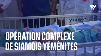 Des médecins saoudiens séparent des jumeaux siamois du Yémen déchiré par la guerre