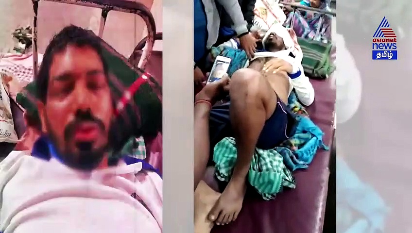 காதலன் மீது ஆசிட் வீசி அதிர வைத்த காதலி.. 'அந்த' விஷயத்திற்கு மறுத்ததால் முகத்தை கோரமாக்கிய பரபரப்பு வீடியோ..!