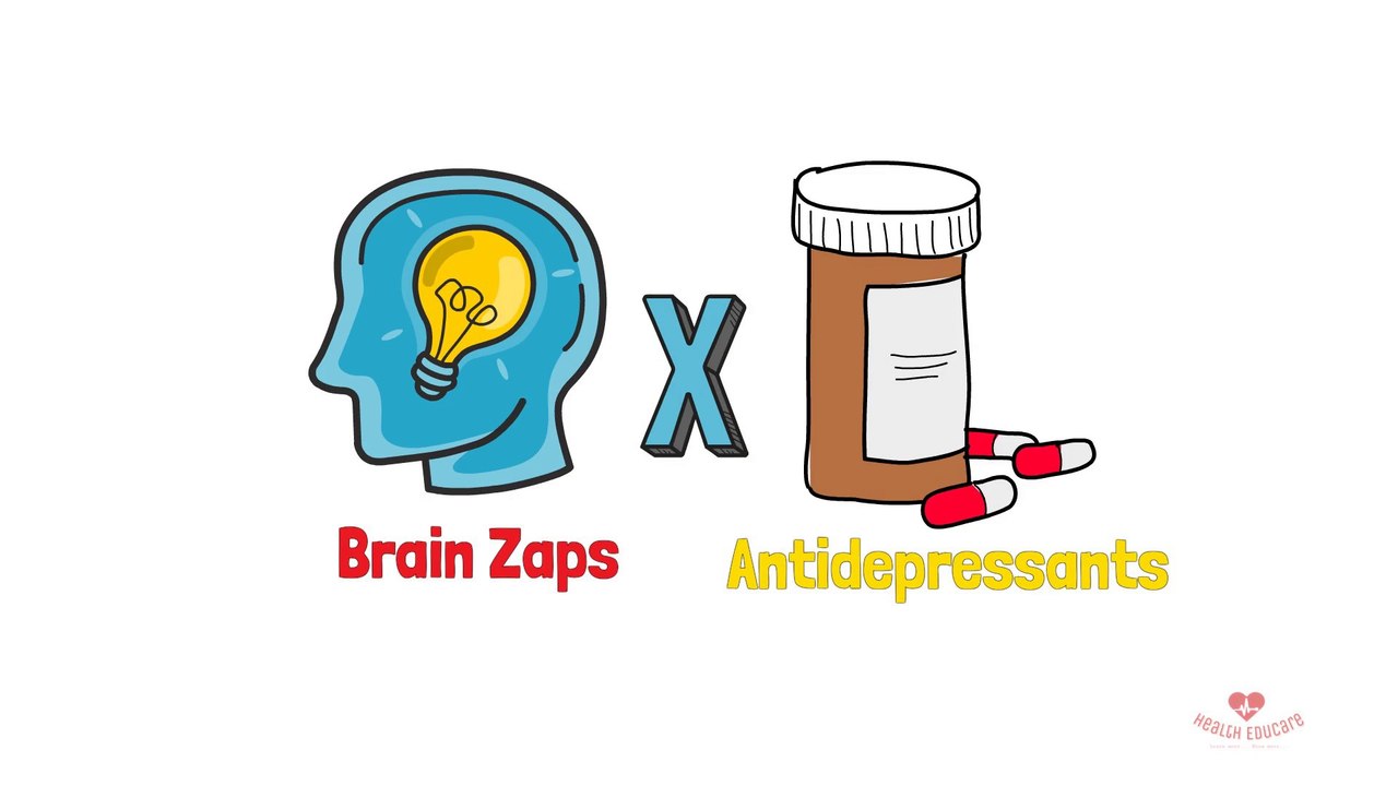 Brain Zaps Electric sensations in the brain video Dailymotion