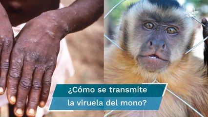 Viruela del mono: ¿Cuál es la población con mayor riesgo de contagio?