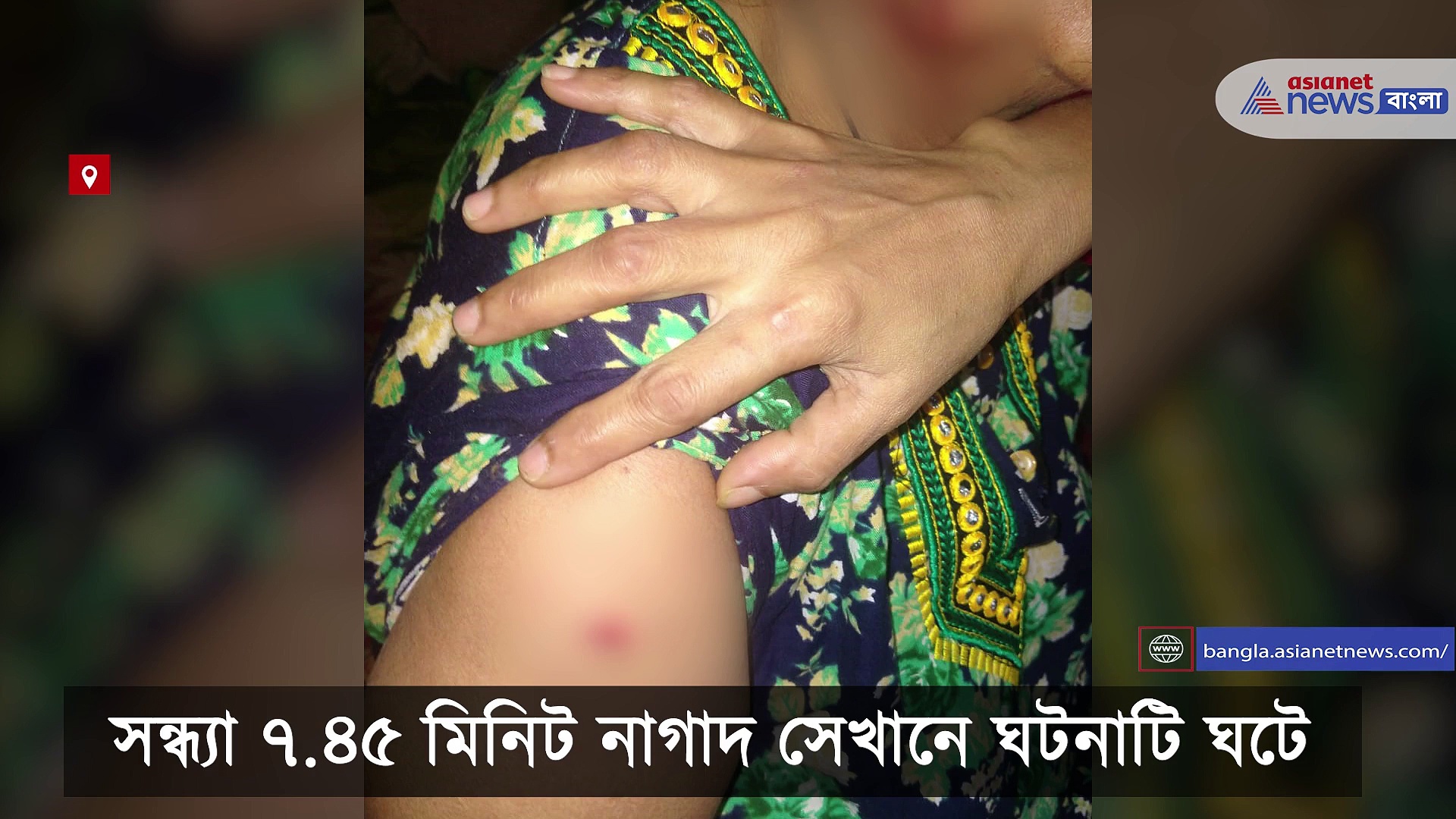 প্রৌঢ়ার সঙ্গে চিতা বাঘের 'মরণ-বাঁচন' লড়াই, ঘটনার মুহূর্তের সিসিটিভি ফুটেজ ভাইরাল