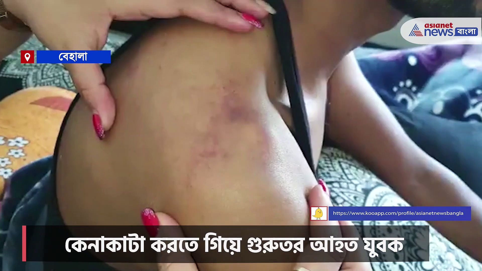 Crime: যুবককে বেধড়ক মারধর, ফের অভিযোগ সিভিক ভলেন্টিয়ারের বিরুদ্ধে