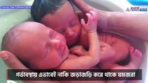 The twin are hugging each other just after their birth