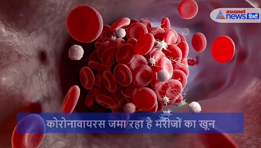 दावा: खून पतला करने की दवा बचा रही कोरोना मरीजों की जान