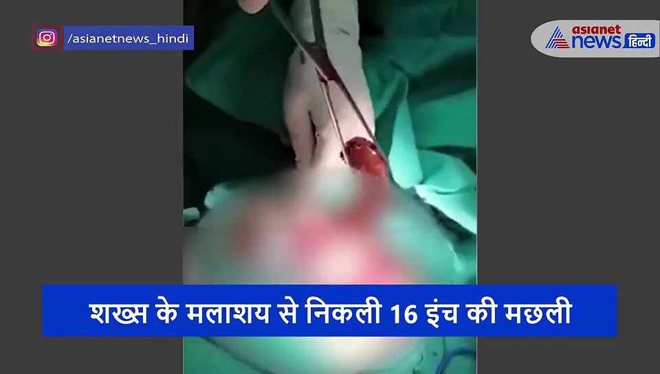 वीडियो: जिंदा मछली पर बैठ गया था शख्स, पीछे से सरक कर घुस गई बॉडी के अंदर