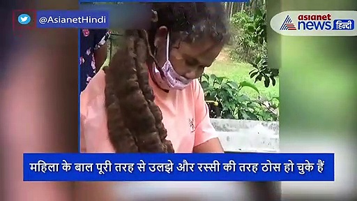 20 साल से महिला ने नहीं धोएं हैं अपने बाल, पीछे की वजह जान रह जाएंगे हैरान