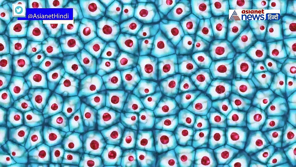 ल्यूकेमिया कैंसर से हुई ऋषि कपूर की मौत, डॉक्टर से जानें इस जानलेवा बीमारी के बारे में..