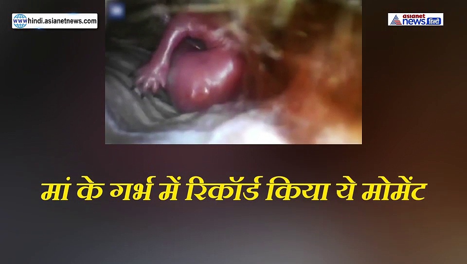 मां के गर्भ में स्पेशल कैमेरा डाल कैद किया गया ये वीडियो, अंदर दिखा अद्भुत नजारा