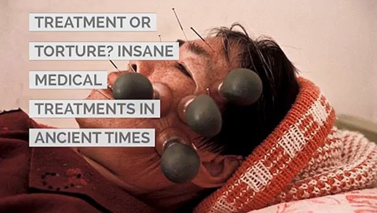 Treatment or Torture? Insane Medical Treatments...