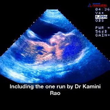 Five ways Bengaluru doctors are cheating patients