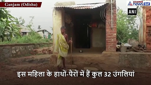 63 साल की महिला के हाथों-पैरों में हैं 32 उंगलियां, लोगों ने डायन करार दिया