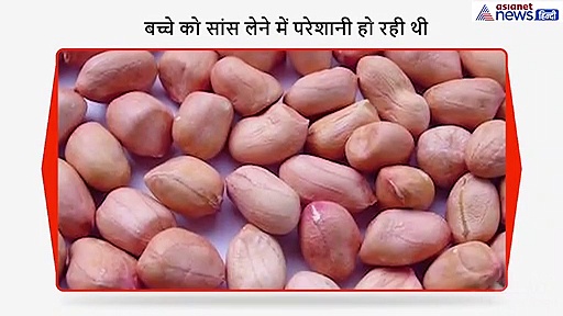 डेढ़ साल के बच्चे की सांस नली में अटका मूंगफली का दाना, जानें कैसे बची मासूम की जान