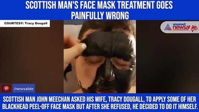 Scottish man's face mask treatment goes painfully wrong