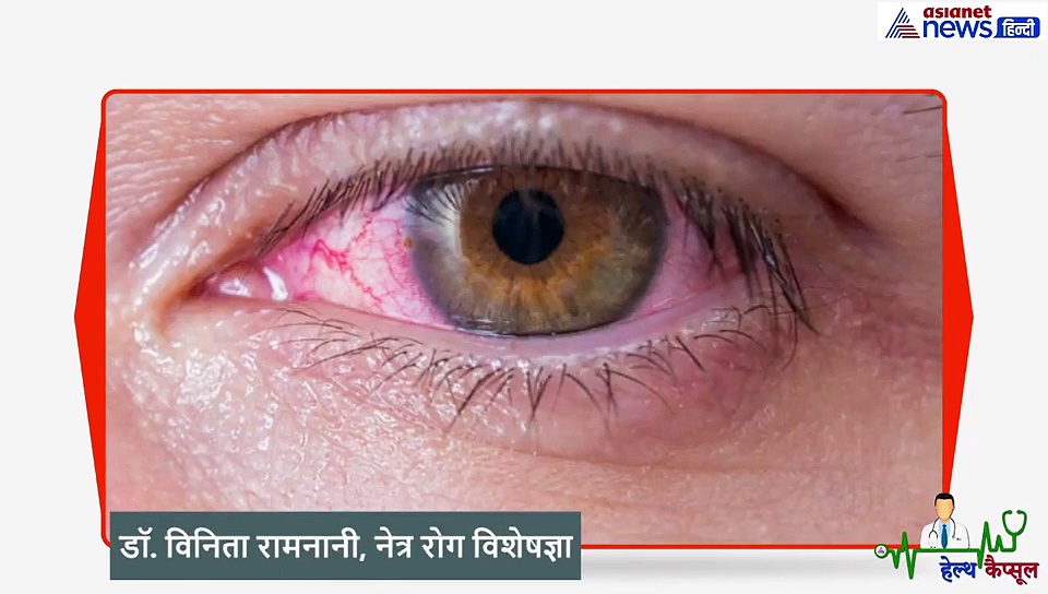 क्या होती है वायरल कंजंक्टिवाइटिस, इस बीमारी से दोनों आंख हो सकती है खराब