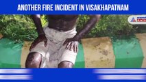 Visakhapatnam: Major fire breaks out at pharmaceutical unit, 1 injured