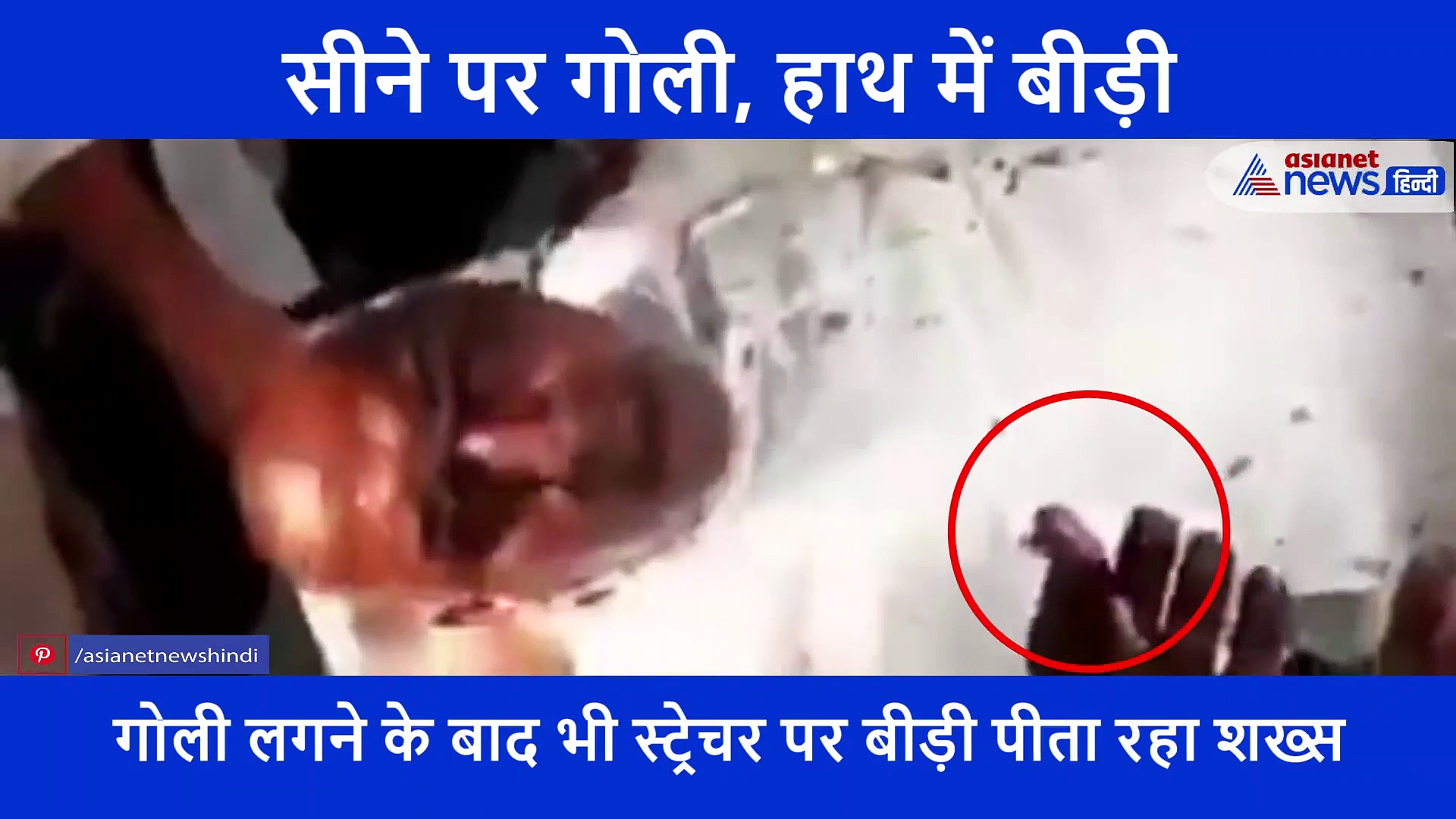 गोली लगने के बाद भी शख्स पीता रहा बीड़ी, वीडियो शेयर कर IPS ने कहा कि 'चीनी कहते हैं जमीन छोड़ दो'