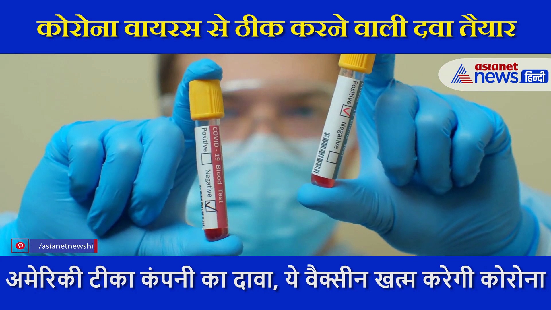 रिसर्च में  दावा- ह्यूमन ट्रायल में सफल हुई ये कोरोना वैक्सीन, इससे खत्म हो जाएगा COVID19