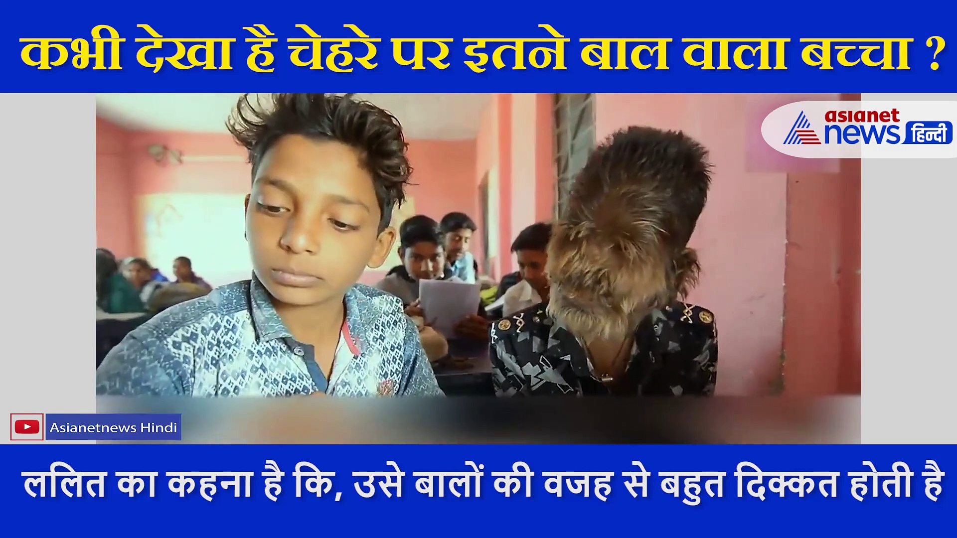 13 साल के लड़के का चेहरा देख डर जाते हैं लोग, देखते ही उसे मारने लगते हैं पत्थर