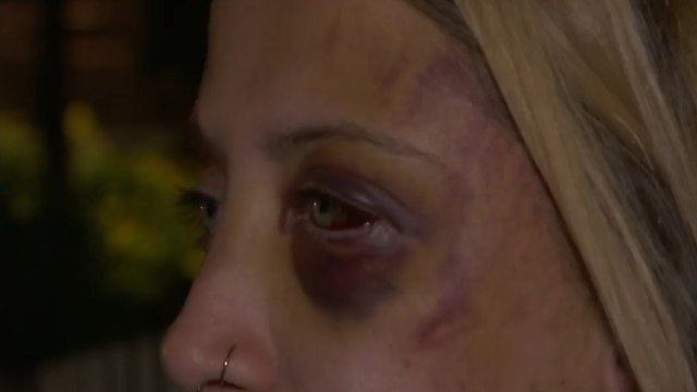 Hombre agredió brutalmente a su pareja por negarse a tener intimidad