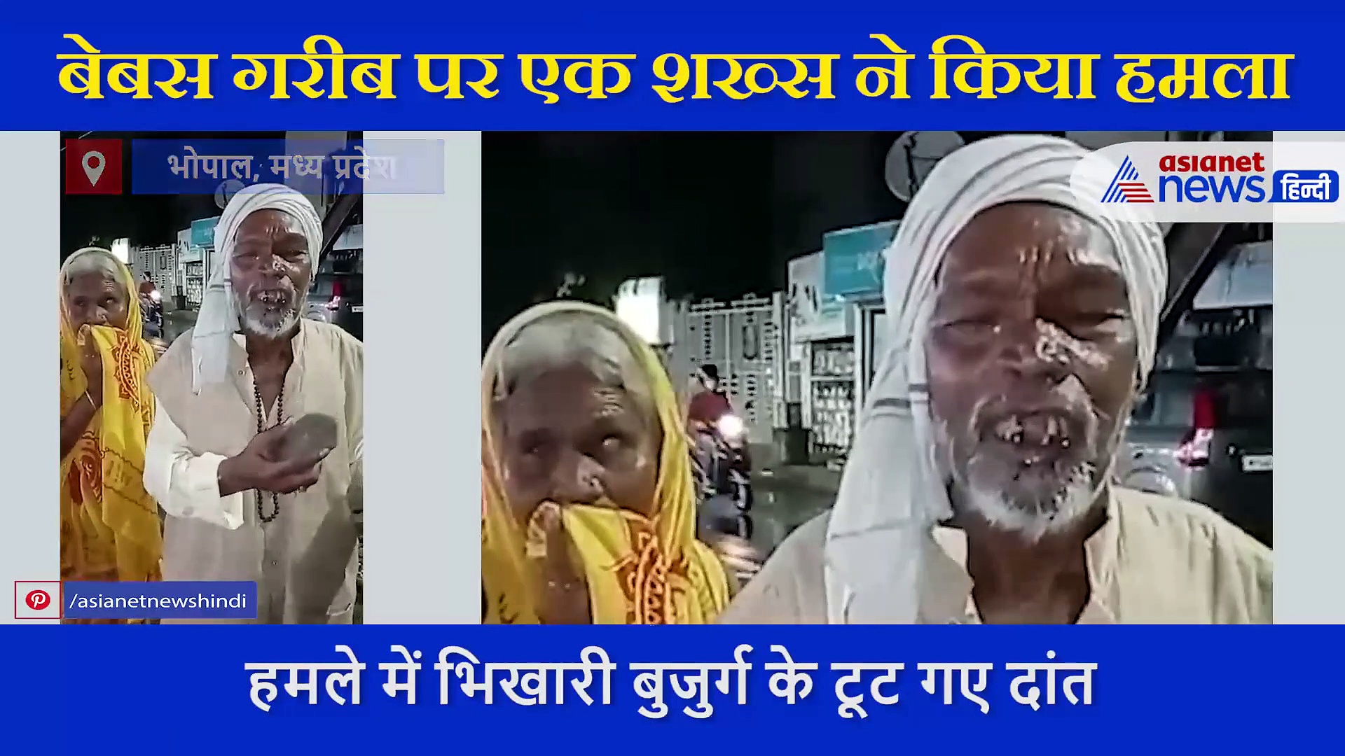 भिखारी पर एक शख्स ने ऐसा बरपाया कहर, टूट गए बुजुर्ग के दांत और बहता रहा खून