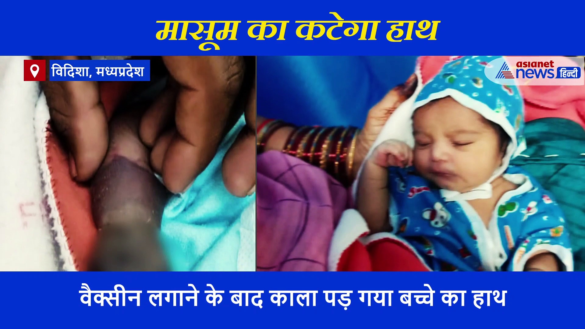 26 अगस्त को जन्म...15 दिन बाद लगा टीका और अब मौत की कगार पर पहुंचा मासूम