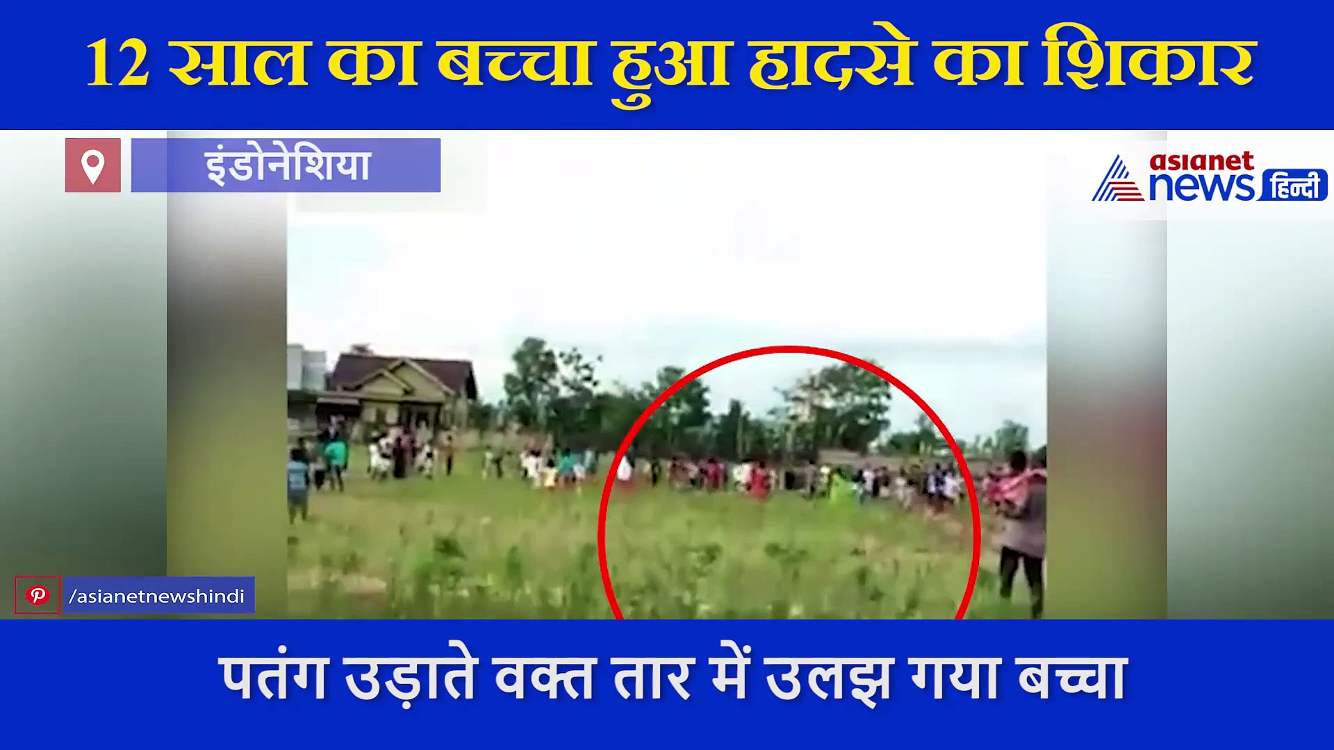 पतंग के साथ 30 फीट तक हवा में उड़ा 12 साल का बच्चा, दोनों हाथे में आए फ्रैक्चर, ऐसे बची जान