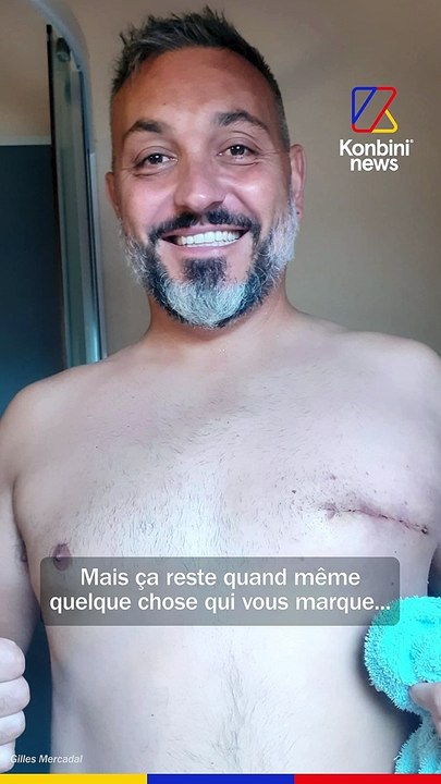 Cancer sur sein : Gilles Mercadal témoigne pour sensibiliser au dépistage masculin