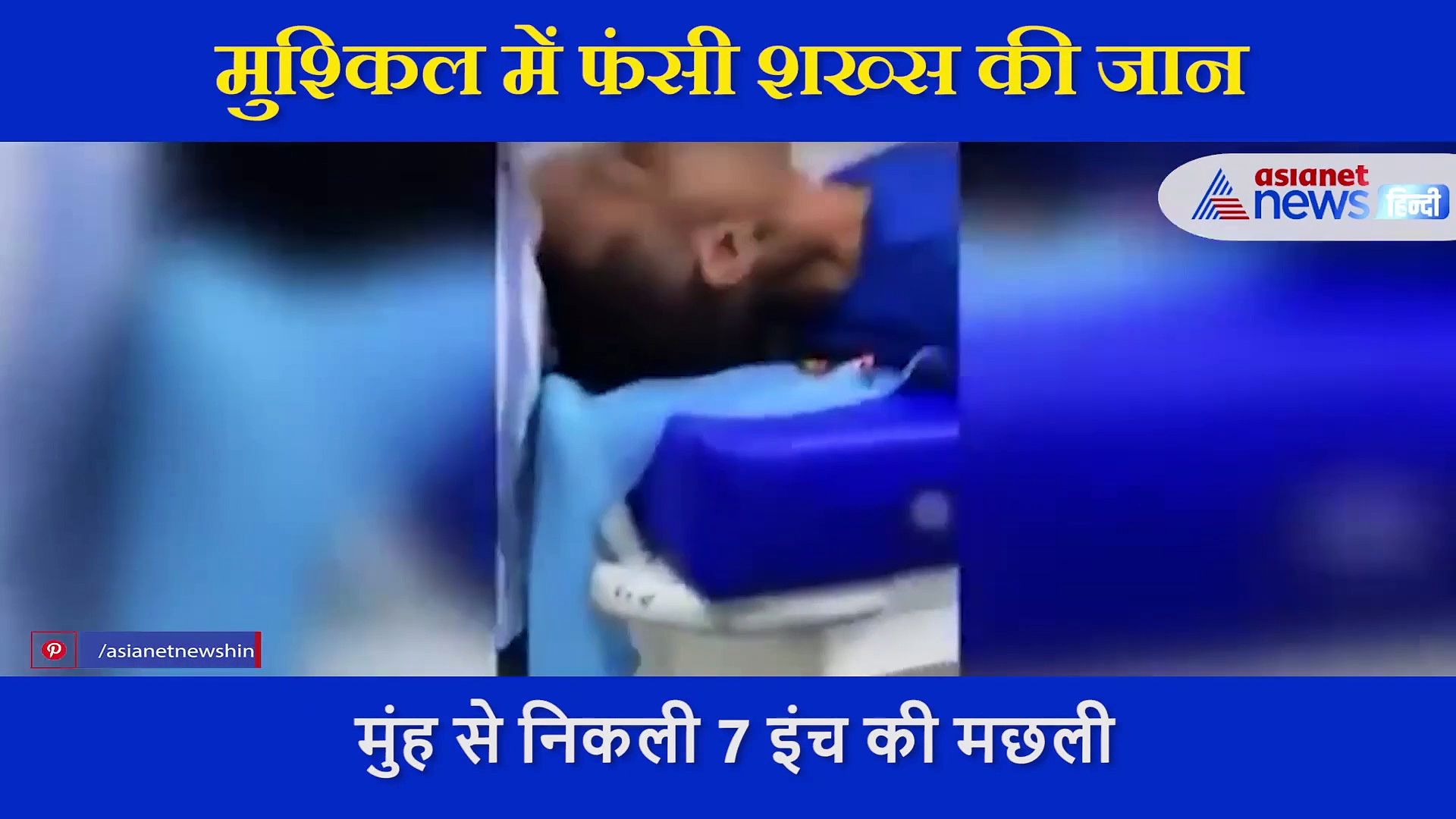 शख्स को सांस लेने में हो रही थी दिक्कत, डॉक्टर ने देखा तो  गले से निकली 7 इंच की मछली,  जानें पूरा मामला