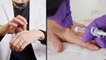 Dermatologist Explains How Hand Filler Works