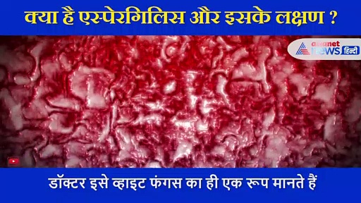 ब्लैक फंगस के बाद अब  एक और बीमारी की दस्तक, जानिए क्या हैं एस्पेरगिलिस के लक्षण