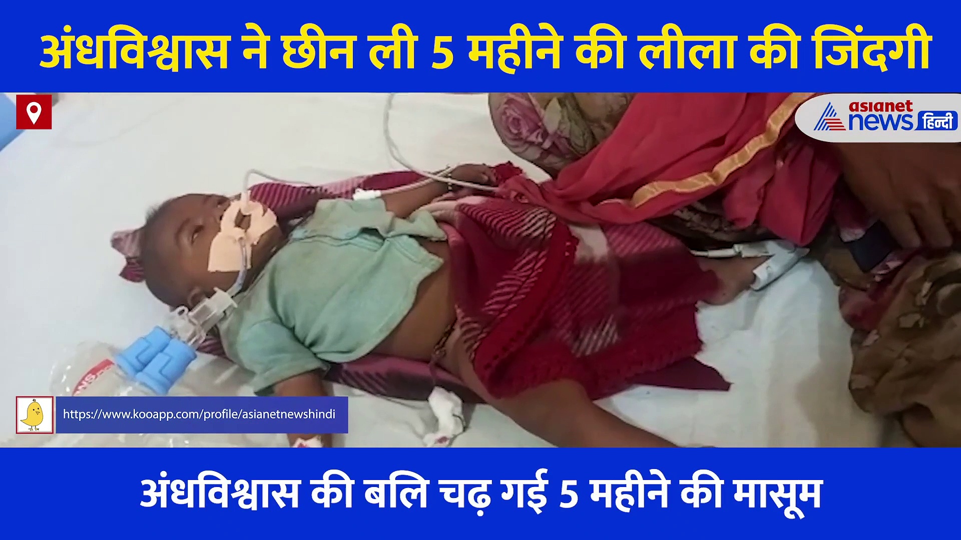 बीमारी से जूझ रही थी 5 महीने की बच्ची, ठीक करने के लिए मां ने सरिया गर्म कर पेट में दाग दिया