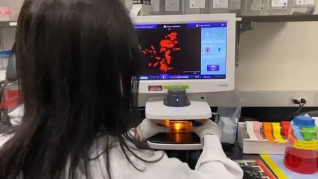 Decretada la alerta sanitaria tras detectarse 23 pacientes sospechosos de tener la viruela del mono