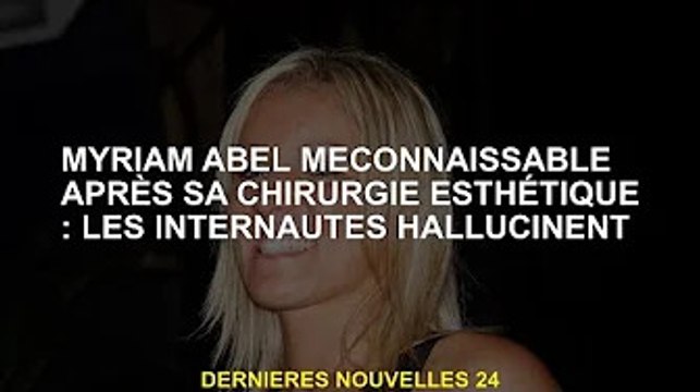 Lifting de Myriam Abel après chirurgie esthétique : les internautes ont des hallucinations