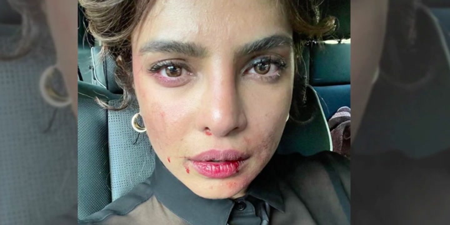 Priyanka Chopra voller Blut: Das steckt dahinter