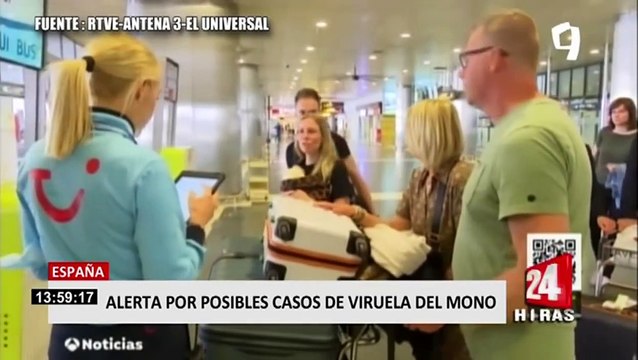 Alerta por viruela del mono: ¿Cómo se contagia y cuáles son sus síntomas?