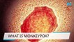 US reports 1st monkeypox case of 2022, Europe reports small outbreaks