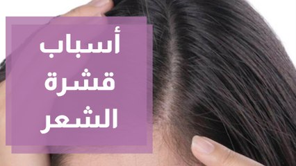 قشرة الشعر أسبابها وعلاجها