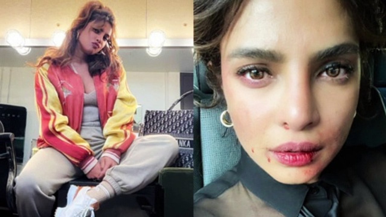 Priyanka Chopra का खून कैसे निकला ? क्या हुआ प्रियंका के साथ ?,prinka chopra l bollywood news, live