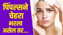 तुमचा पण चेहरा पिंपल्सने भरलाय का? | How To Remove Pimples | Remove Pimples Naturally | Skin Care
