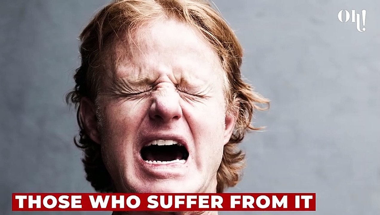 What are Cluster Headaches? Here are the symptoms, causes and the cure