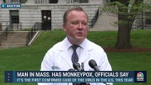 La variole du singe se répand dans plusieurs pays aux USA et en Europe