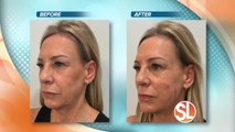 UGlow Face & Body: Look refreshed with a ​non-surgical facelift