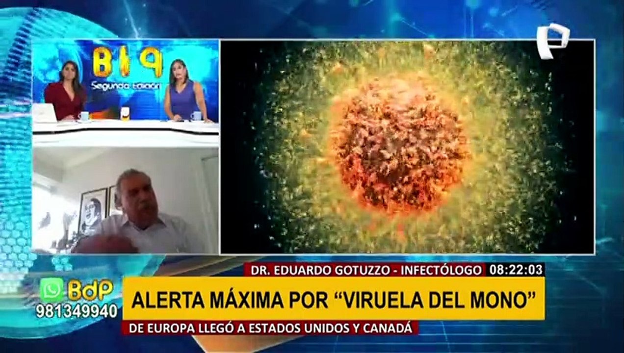 Viruela del Mono: "La opción de que llegue a América Latina es muy baja", asegura Dr. Gotuzzo