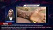 What is monkeypox? What to know about virus, symptoms, spread as US confirms 1st 2022 case - 1breaki