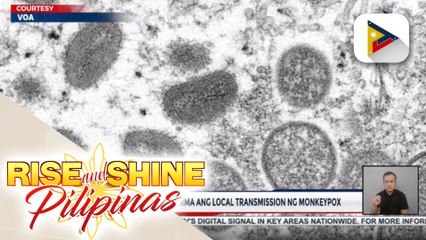 United Kingdom, kinumpirma ang local transmission ng monkeypox