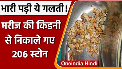 Hyderabad: Kidney से निकाले गए 206 stones, छोटी सी भूल पड़ी भारी | वनइंडिया हिंदी