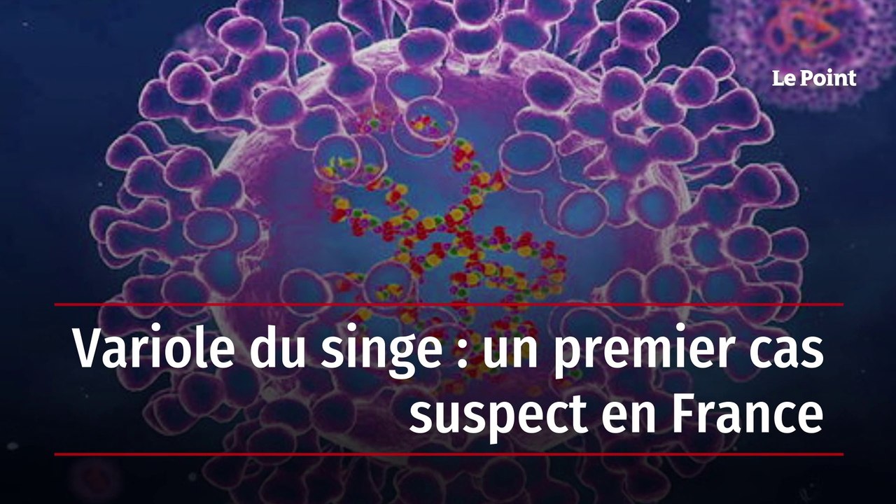 Variole du singe : un premier cas suspect en France