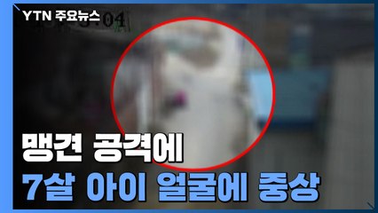 또 개물림 사고...맹견 공격에 7살 아이 얼굴에 중상 / YTN