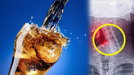 कोलड्रिंक पीने के बाद क्या होता है | कोलड्रिंक पीने के नुकसान |Boldsky